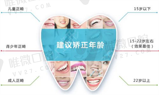 窝沟封闭是换完牙以后做吗,窝沟封闭全流程(图1)